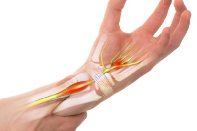 Understanding Carpal Tunnel Syndrome and Wrist Pain