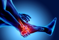 Finding Relief From Arthritis Through Chiropractic Care